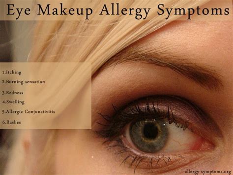 symptoms of eye makeup allergy.